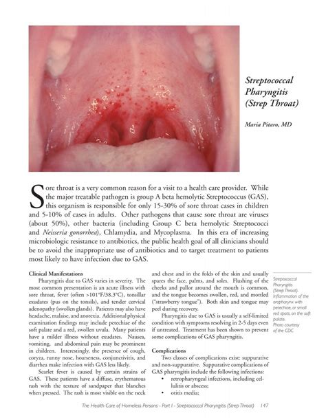 Streptococcal Pharyngitis .